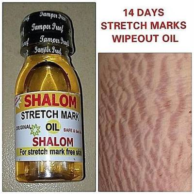 Shalom Stretch mark Oil