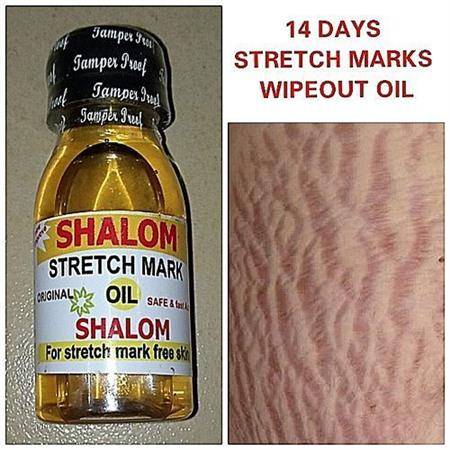 Shalom Stretch mark Oil