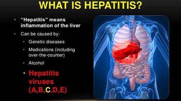 HEPATITIS REMEDY