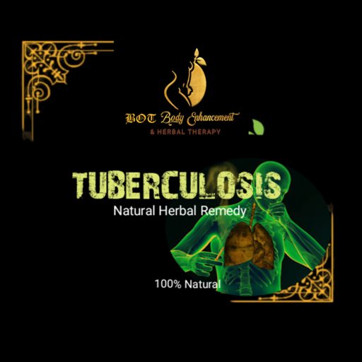 Tuberculosis