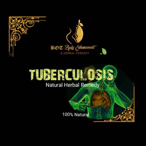 Tuberculosis