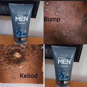 Aftershave