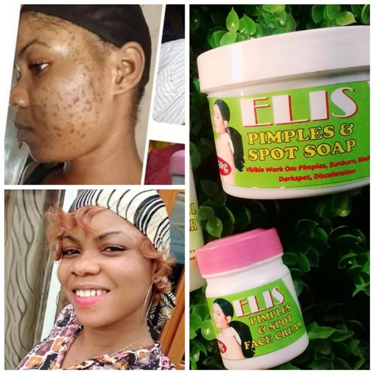 Pimples and spot soap. For all skin type