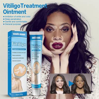 SOUTH MOON Vitiligo Removal Ointment Tre
