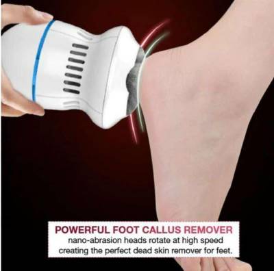 FOOT CALLUS REMOVER